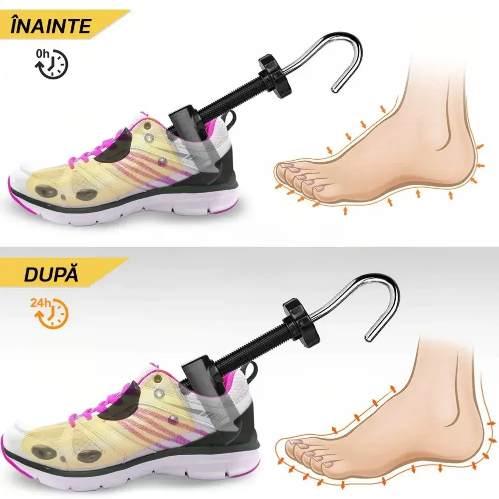 Set 2 Sanuri/Calapoade Reglabilile, pentru Alungit si Largit Pantofi, Geanta si Incaltator Incluse, Universale, Unisex, din ABS Premium, Arc, Marime 40 - 47, Galben/Negru (6)